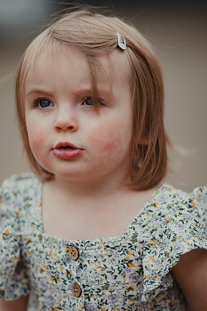 _SBA7339